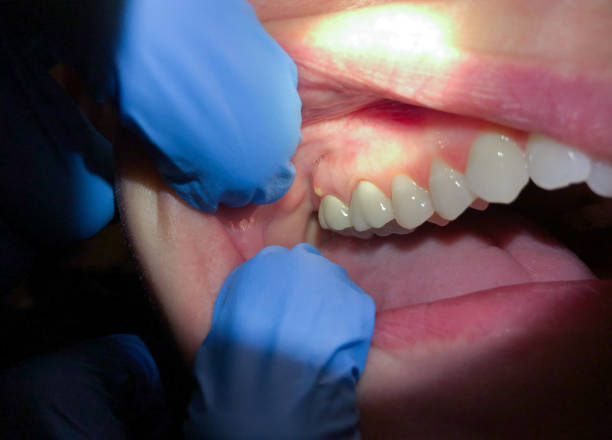 Best Cracked Tooth Emergency Dentist  in Euclid, OH