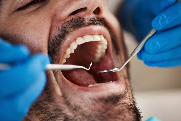 Best Knocked-Out Tooth Emergency  in Euclid, OH