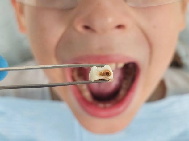 Best Emergency Tooth Extraction  in Euclid, OH